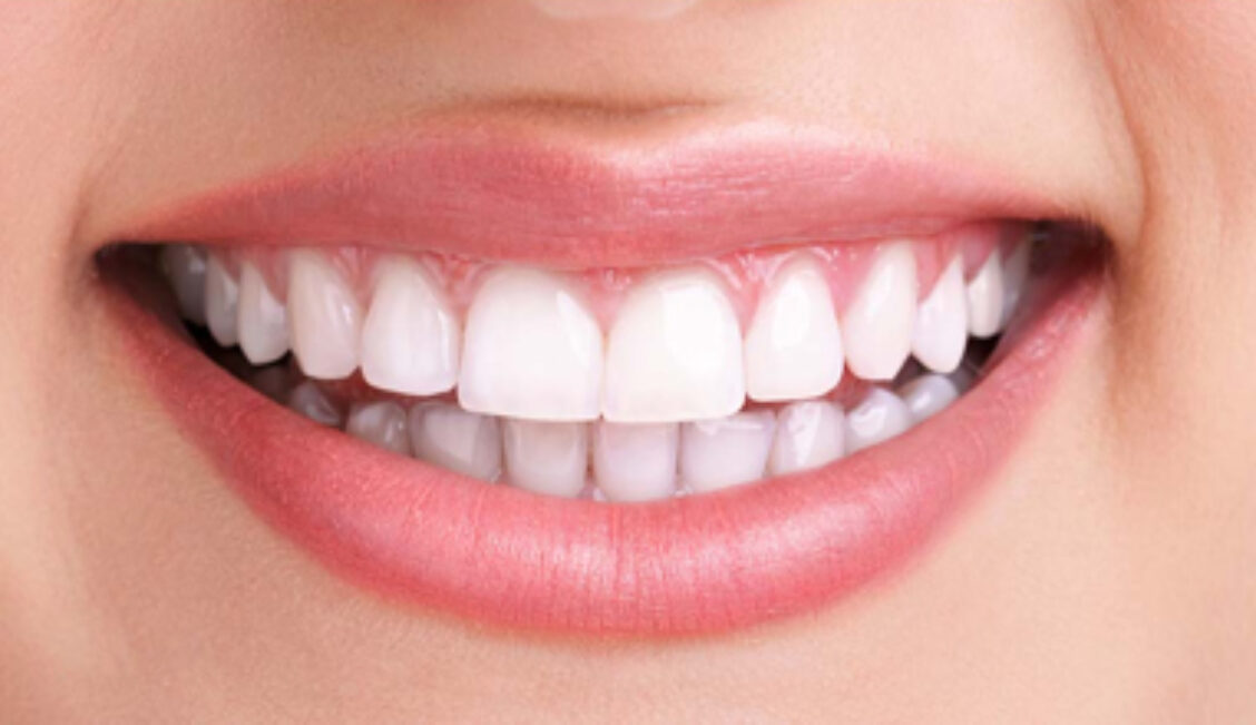 After - Sistova Road Dental Studio