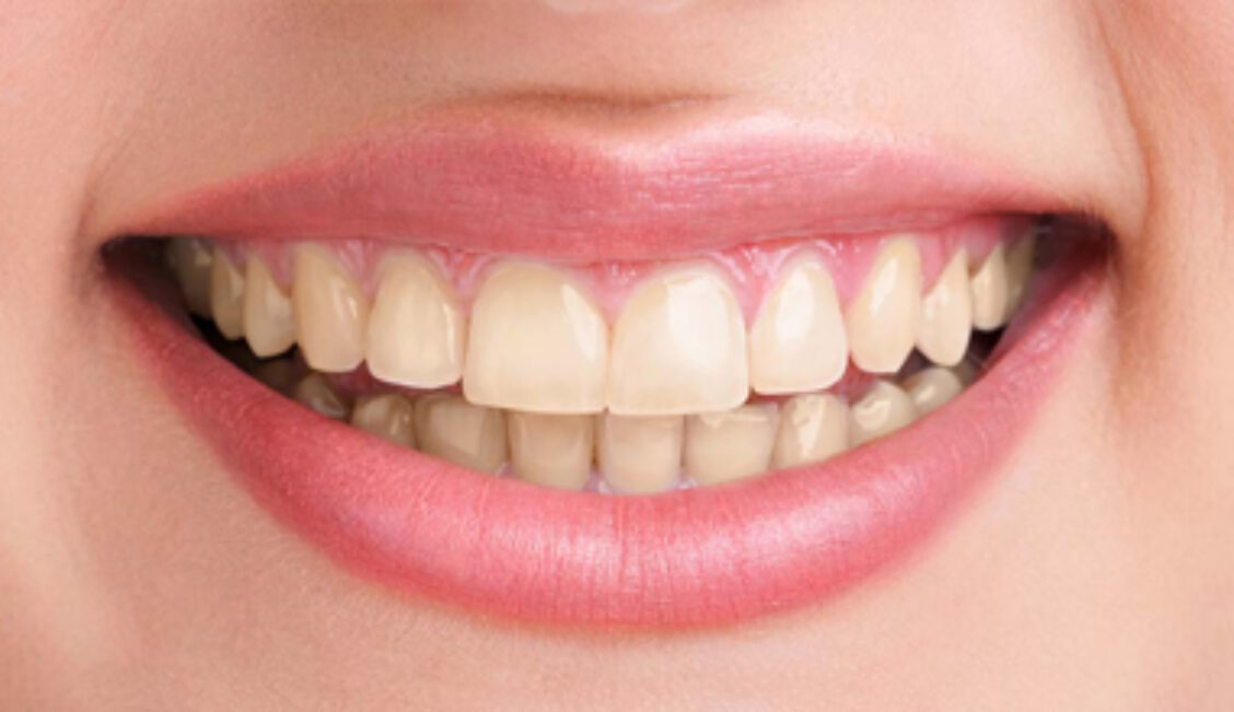 Before - Sistova Road Dental Studio